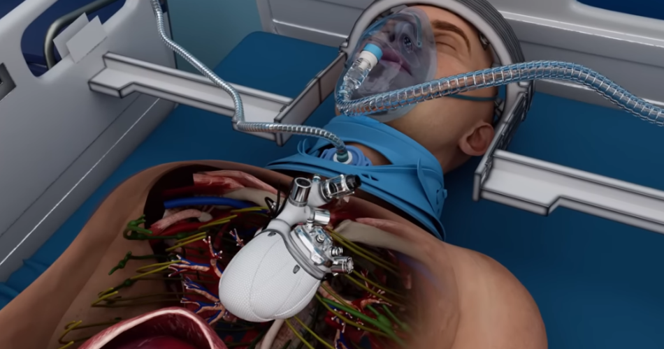 In the high-stakes environment of an American hospital or clinic, few moments are as critical as cardiac arrest.